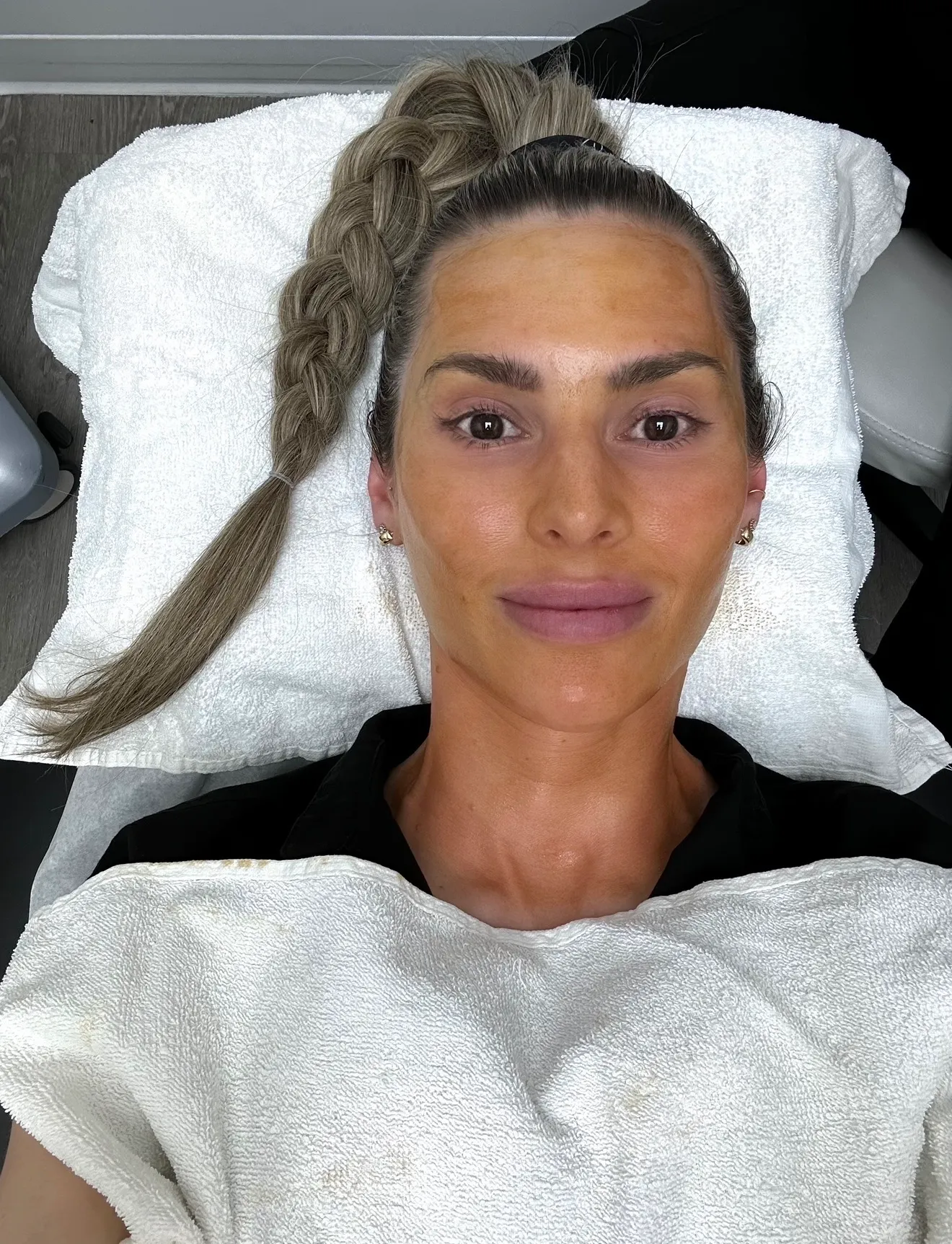 A patient resting in the treatment room, skin prepped for a chemical peel